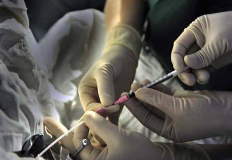 做试管精子和卵子有没有经过筛查,试管婴儿和人工授精选择