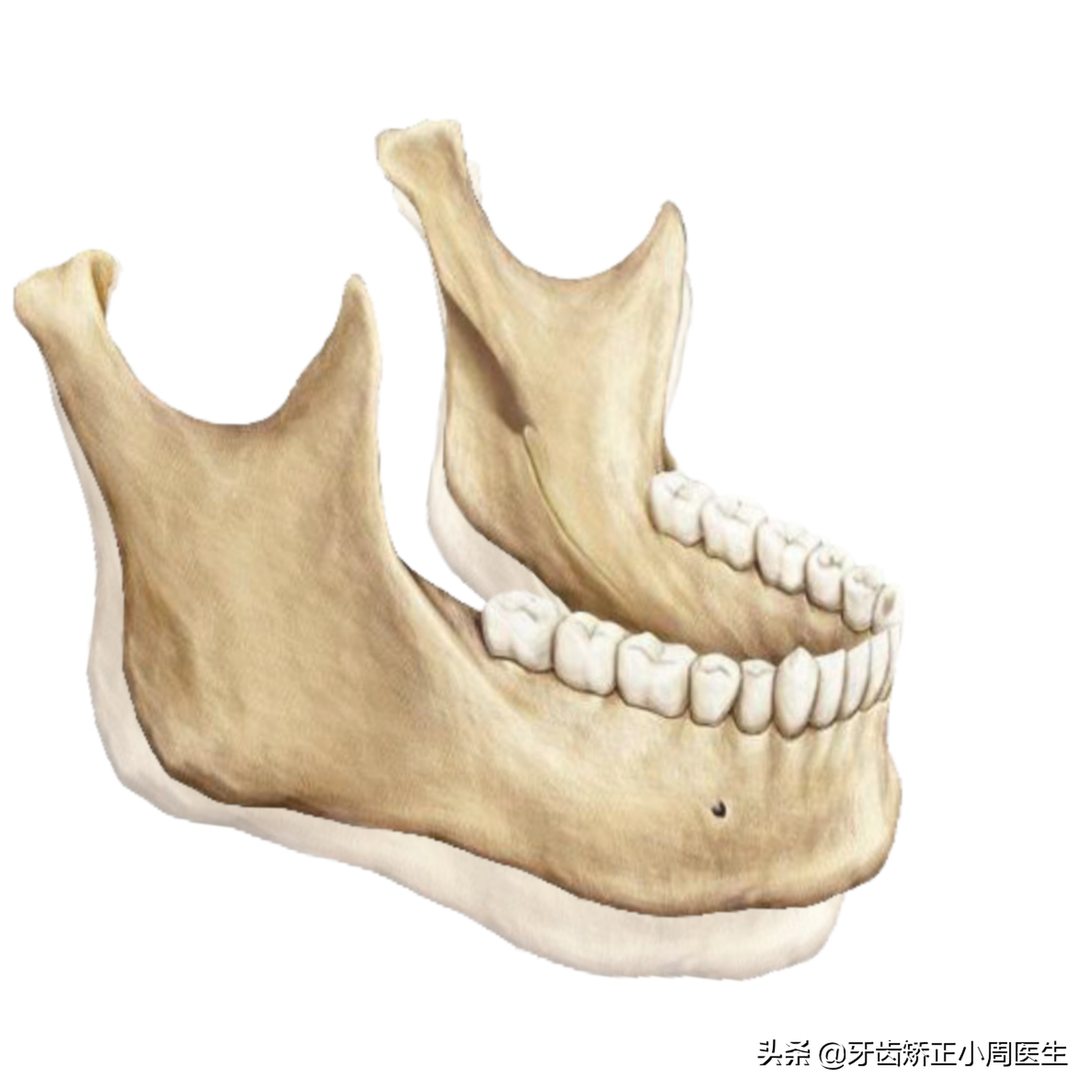 下巴后缩整容玻尿酸还是假体,如何不靠整容改变下巴