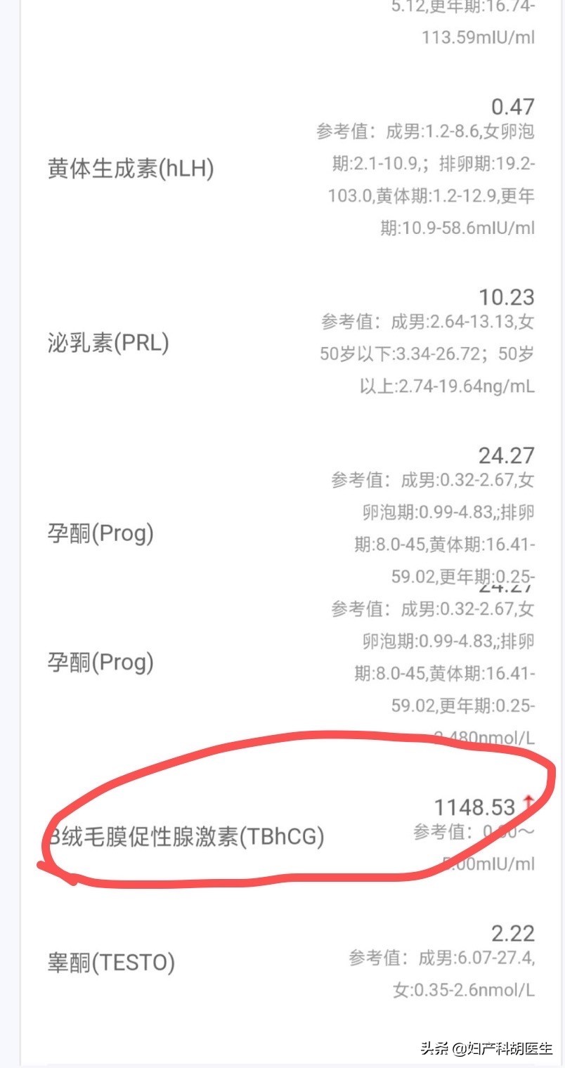怀孕真的不会来月经了吗,辟谣怀孕不能做的事