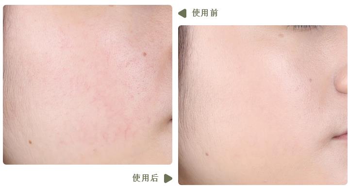 测大牌气垫,五款大热气垫真实测评