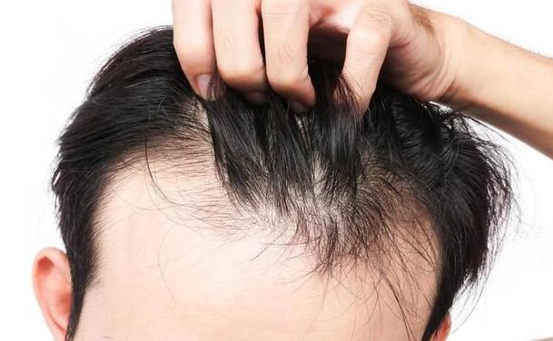 甲减哪个值到10了需要吃药,健康甲减的十大信号你有几个