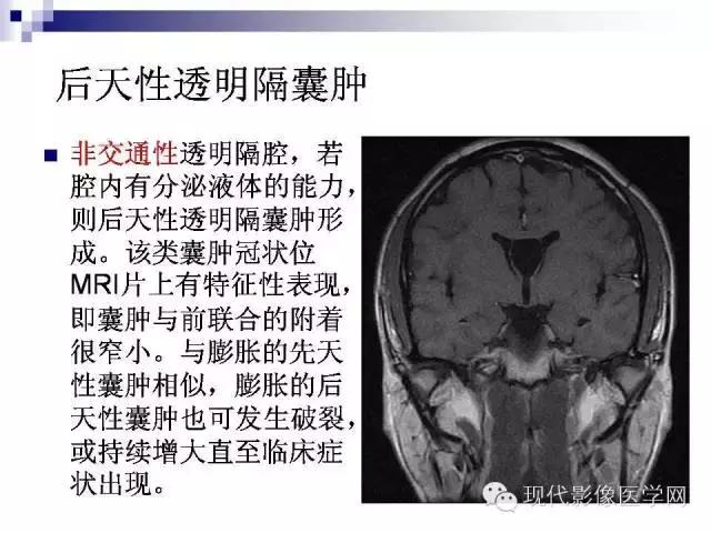 成年人透明隔腔增宽能活多久,透明隔缺如临床意义