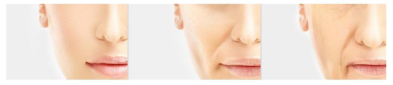 鼻整形五十年后,鼻整形修复三次