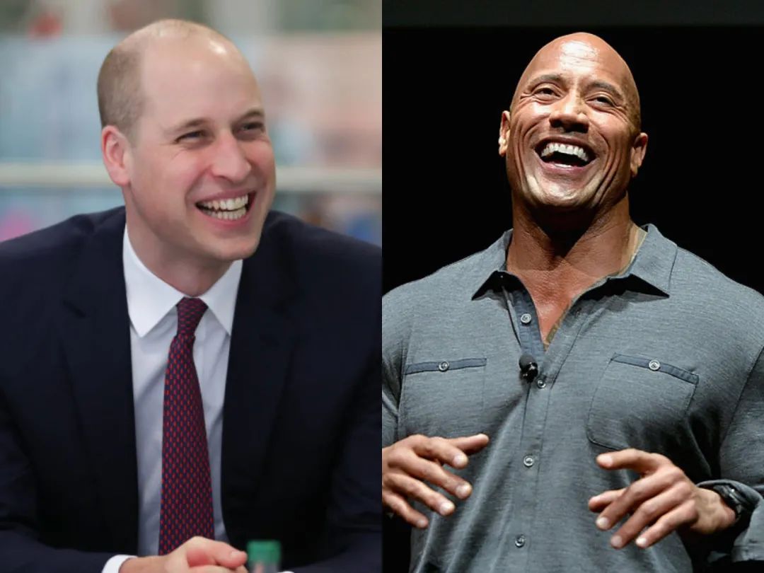 威廉王子秃顶了哈里为啥没秃顶,威廉王子为什么喜欢秃顶