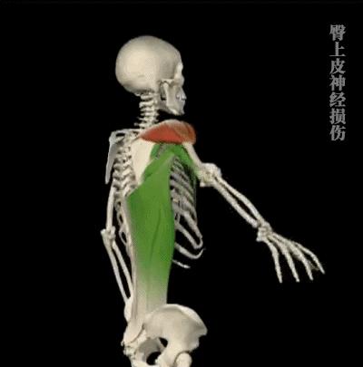 脊柱侧弯治好了，为什么患者反而治坏了？内附髋关节平衡松动法