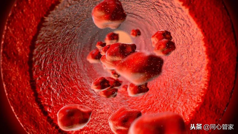 不想搭桥是否可以保守治疗,年轻人心梗支架与溶栓哪个好