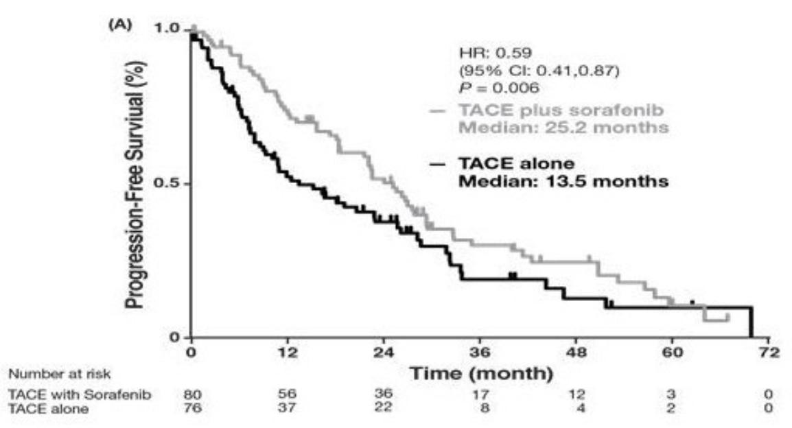 介入栓塞联合靶向药物治疗中晚期肝癌疗效更佳