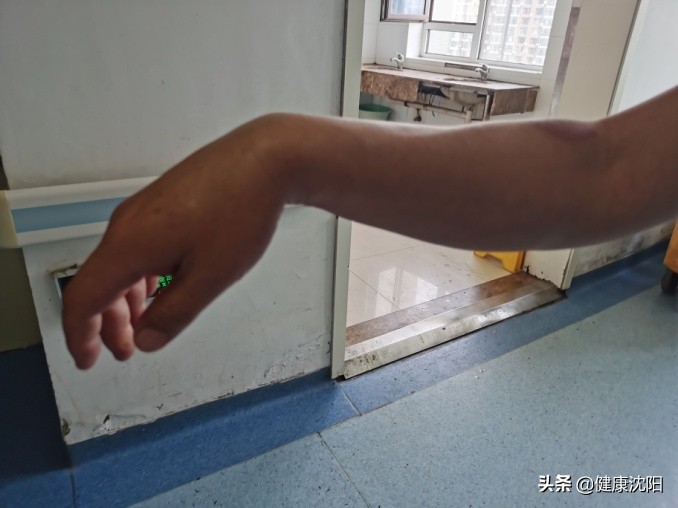 健康科普堂|周末综合征——宿醉醒后右手不能抬起的青年男性