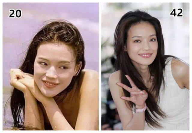 那些一刀切削骨的明星还好吗？后遗症一大堆，小方脸成最大赢家