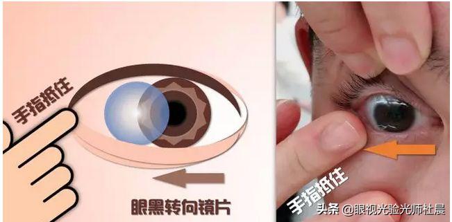 初次戴隐形眼镜感觉有点眩晕,初次戴隐形眼镜怎么取下来