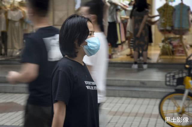 美女为生娃导致面部畸形,流浪街头自救:想活久一点,陪儿子长大