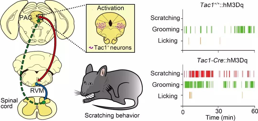 阿尔茨海默论文,检测阿尔茨海默症最新研究