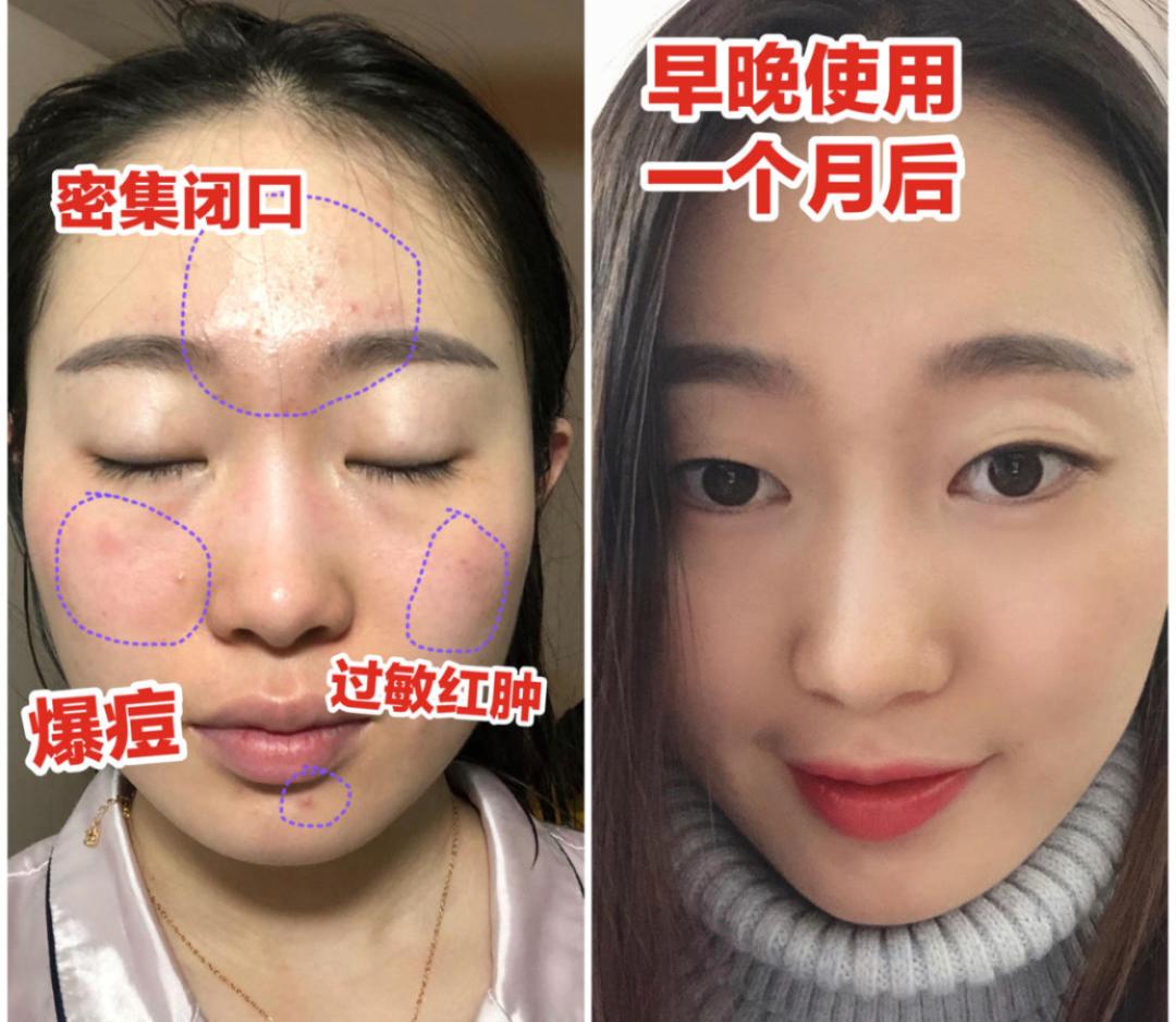 销品商城|“人类高质量女生”秋季必备护肤单品