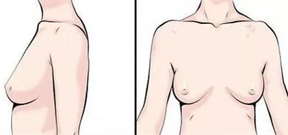 改善胸型内衣推荐购买,如何选择适合自己的内衣图解