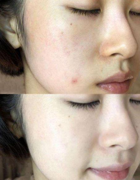 李佳琦晒出自用的精华液，一瓶才不到50块，被称为平价兰蔻