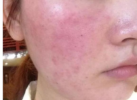 有必要买孕妇专用护肤品吗,孕妇专用护肤品坑爹吗图片