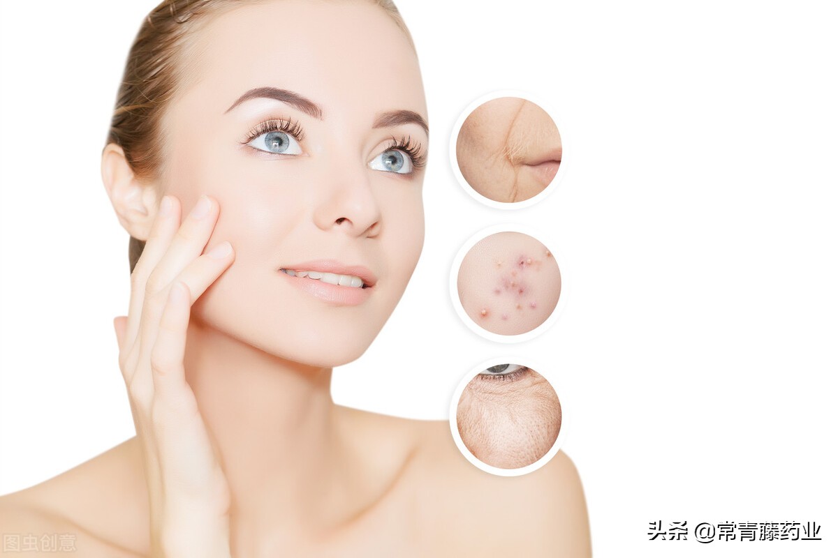 眼睛周围有脂肪粒可以冷冻去除吗,生姜可以去除眼睛周围脂肪粒么