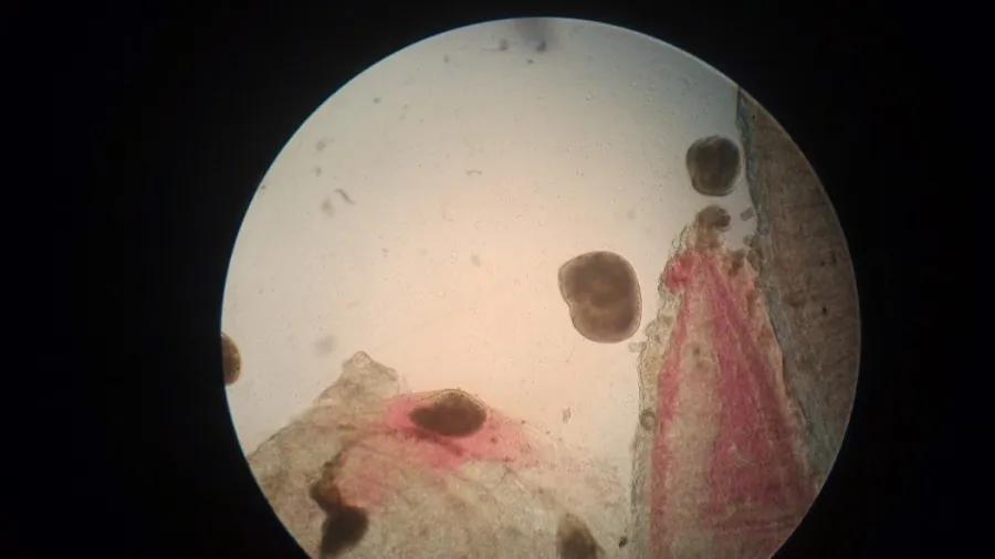 一线渔医良心分享！这份《江高区域全年病害防控指南》请收好