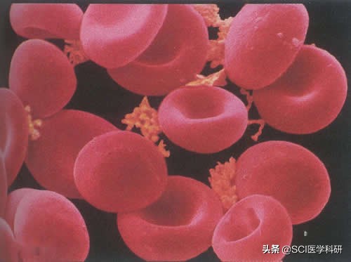 补铁注意事项及安全知识,补铁过多会拉肚子吗