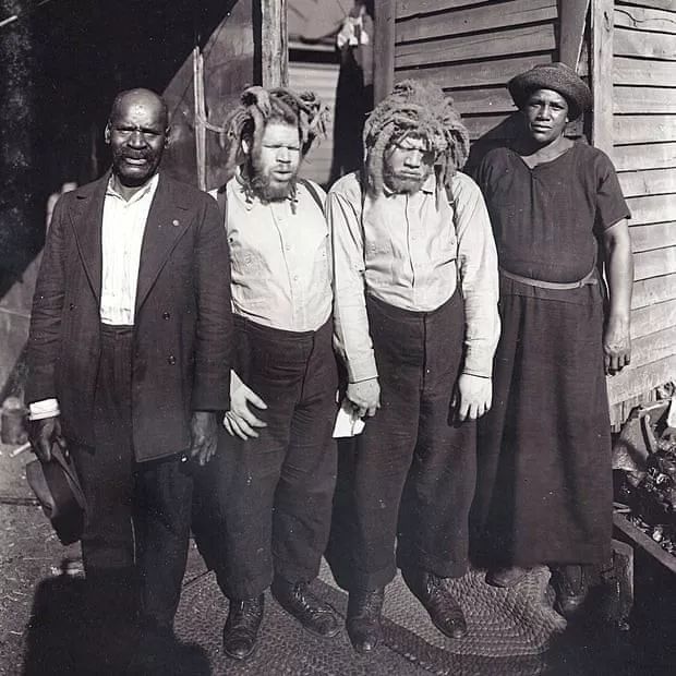 得了白化病的黑人，在百年前的美国，被迫出演畸形秀、被残忍猎杀