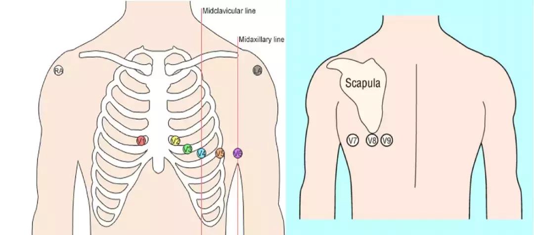 心电图和心脏彩超以哪个为准,心电图和心脏超声是一样吗