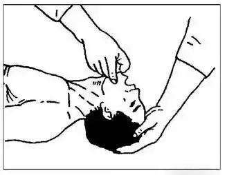 10千伏触电急救方法,电力人员正确触电抢救法