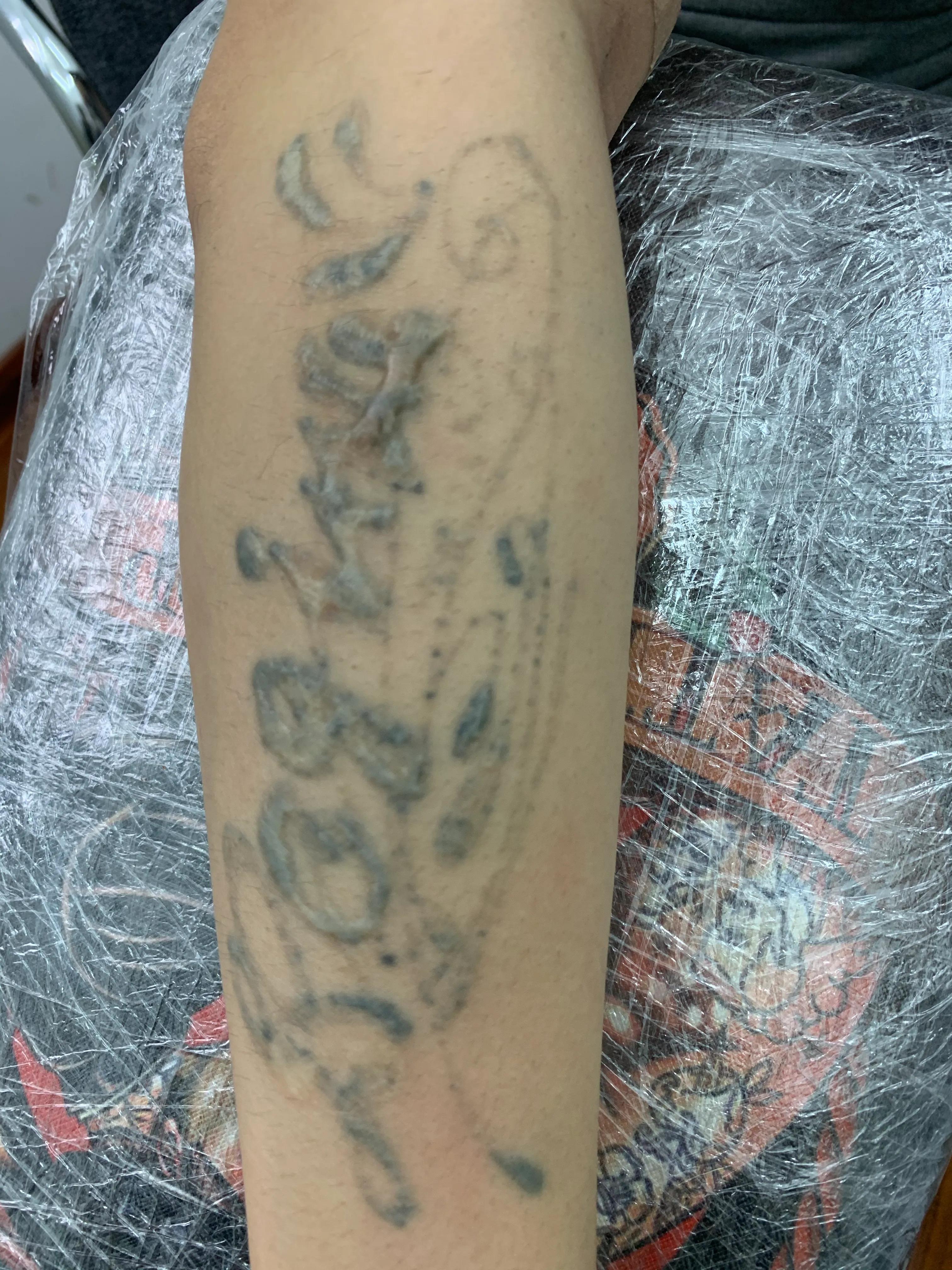 洗文身到底能不能洗干净？