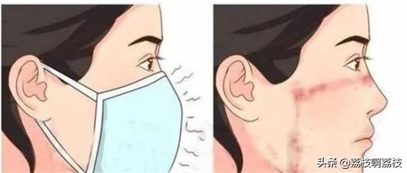 为什么痘痘总是长在同一位置上,同一个位置反复长痘痘怎么治