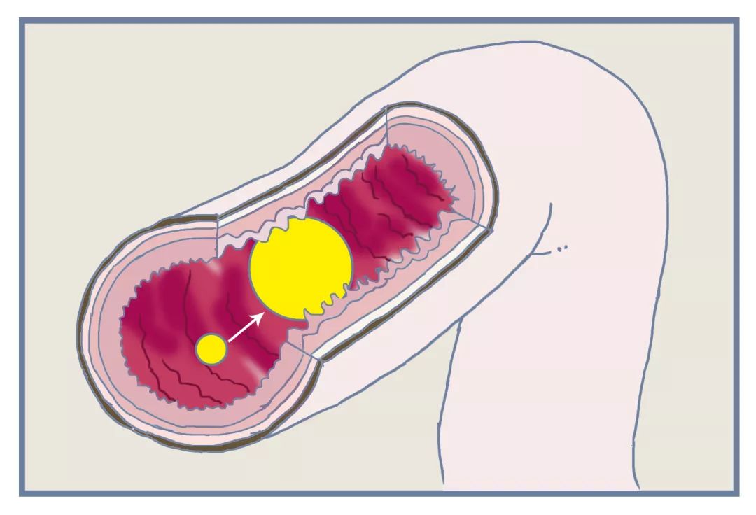 便秘在药店推荐的药品,大家都在用什么药治疗便秘