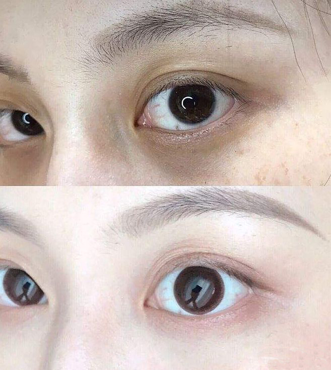 对付黑眼圈最好用的眼霜,真正对黑眼圈有用的眼霜