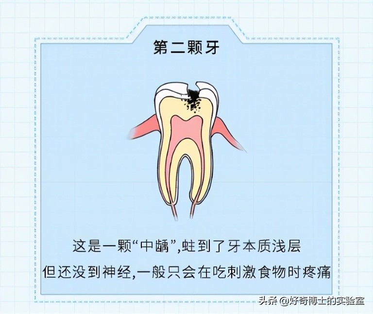治牙到底有多恐怖,治牙有多痛苦