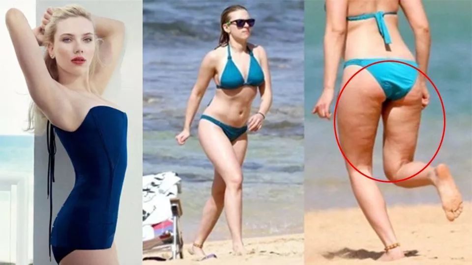 瘦下来橘皮会消失吗,橘皮组织肥胖怎么办