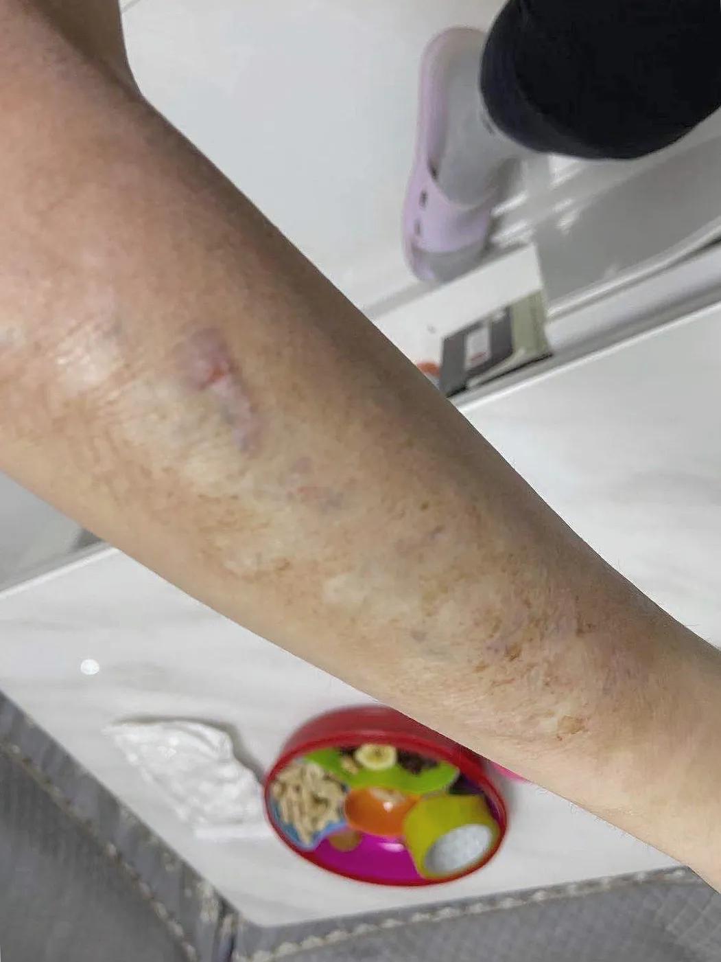 洗纹身能彻底洗掉吗豆瓣,纹身能彻底洗干净吗