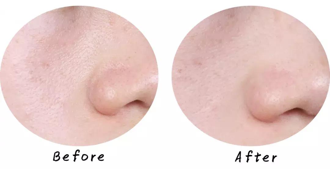 最好用清洁面膜排行榜前十名图片,公认最好用的清洁面膜混油皮