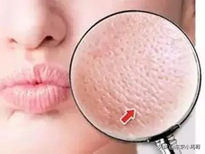 改善毛孔粗大的护肤习惯,可以改善毛孔粗大的护肤方法