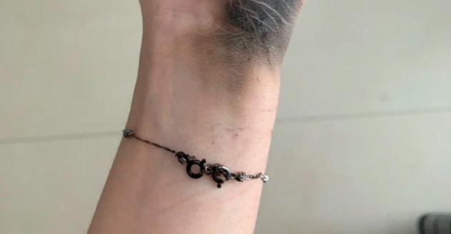 充电器爆炸安全隐患有哪些,充电器爆炸到底有多可怕