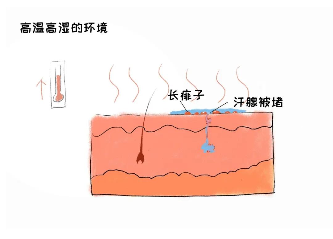 夏天到了宝宝如何防蚊,夏天到了怎么防蚊