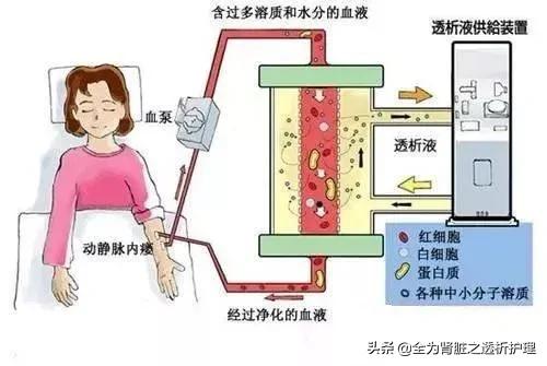血透常见并发症及预防,血透常见报警原因及处理