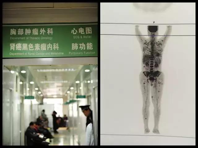 这些癌变信号别大意,这些癌前病变千万别忽略