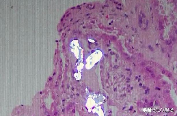 喝自己泡的果酒中毒,自己泡的水果酒有什么危害