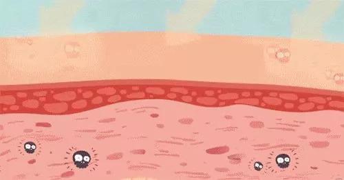 毛孔粗大如何改善治愈系,解决毛孔粗大最有效医美的方法