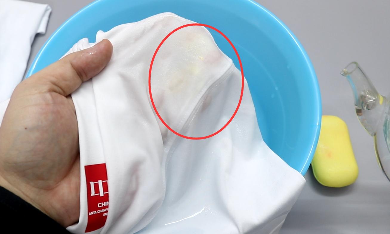 白色衣服染到血渍怎么洗掉,白衣服上有血渍怎么清洗干净