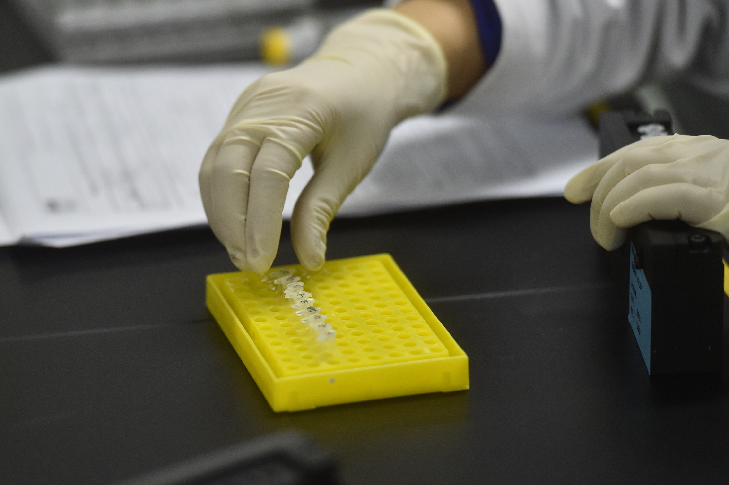 硬纤维瘤是长在皮肤表面吗,硬纤维瘤是什么样