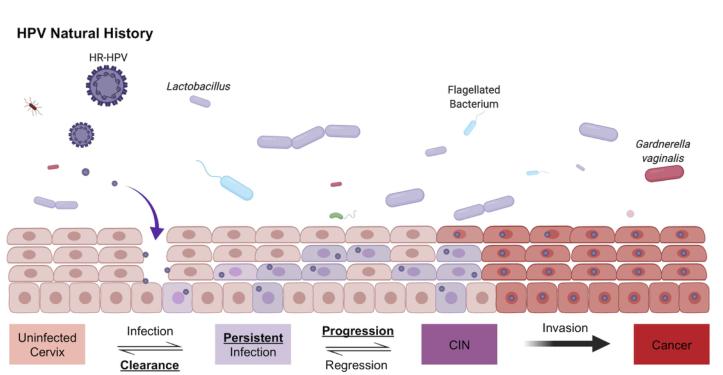 不用检测HPV，只用鉴定微生物组或可预测感染HPV前期癌症风险