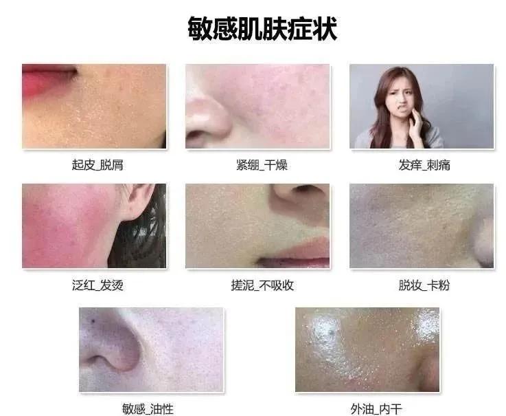 换季护肤面霜大牌,换季护肤大作战视频