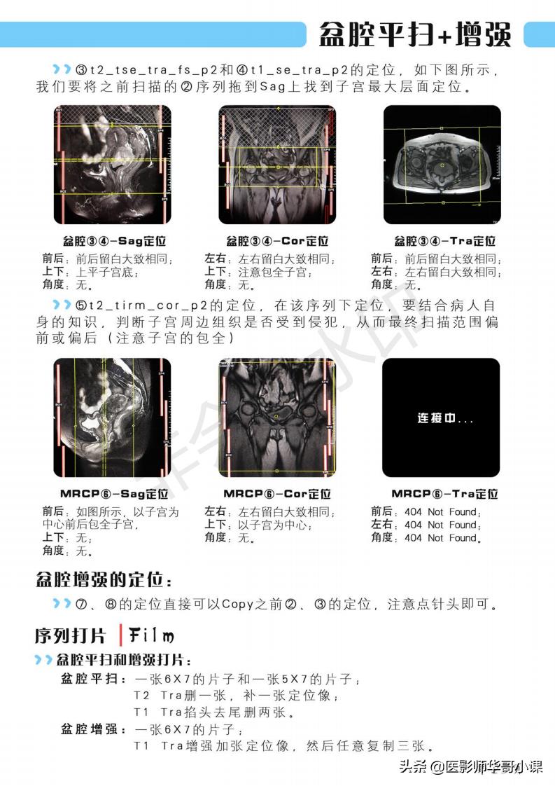 磁共振扫描技术西门子,西门子磁共振最新操作界面