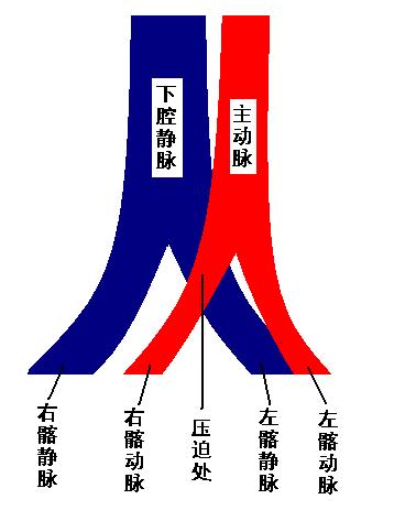 为什么肿腿,一条左腿浮肿是什么原因