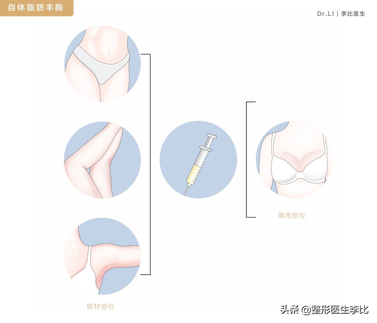 我有一对不会长大的胸，怎么办？（含案例）
