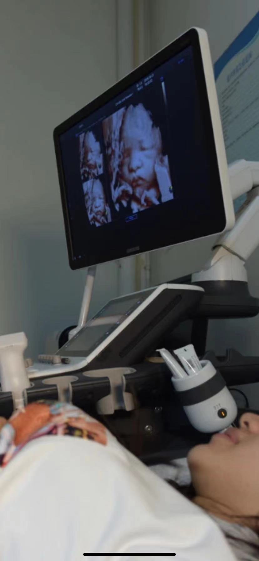 关于孕期产检几个大家关心的问题