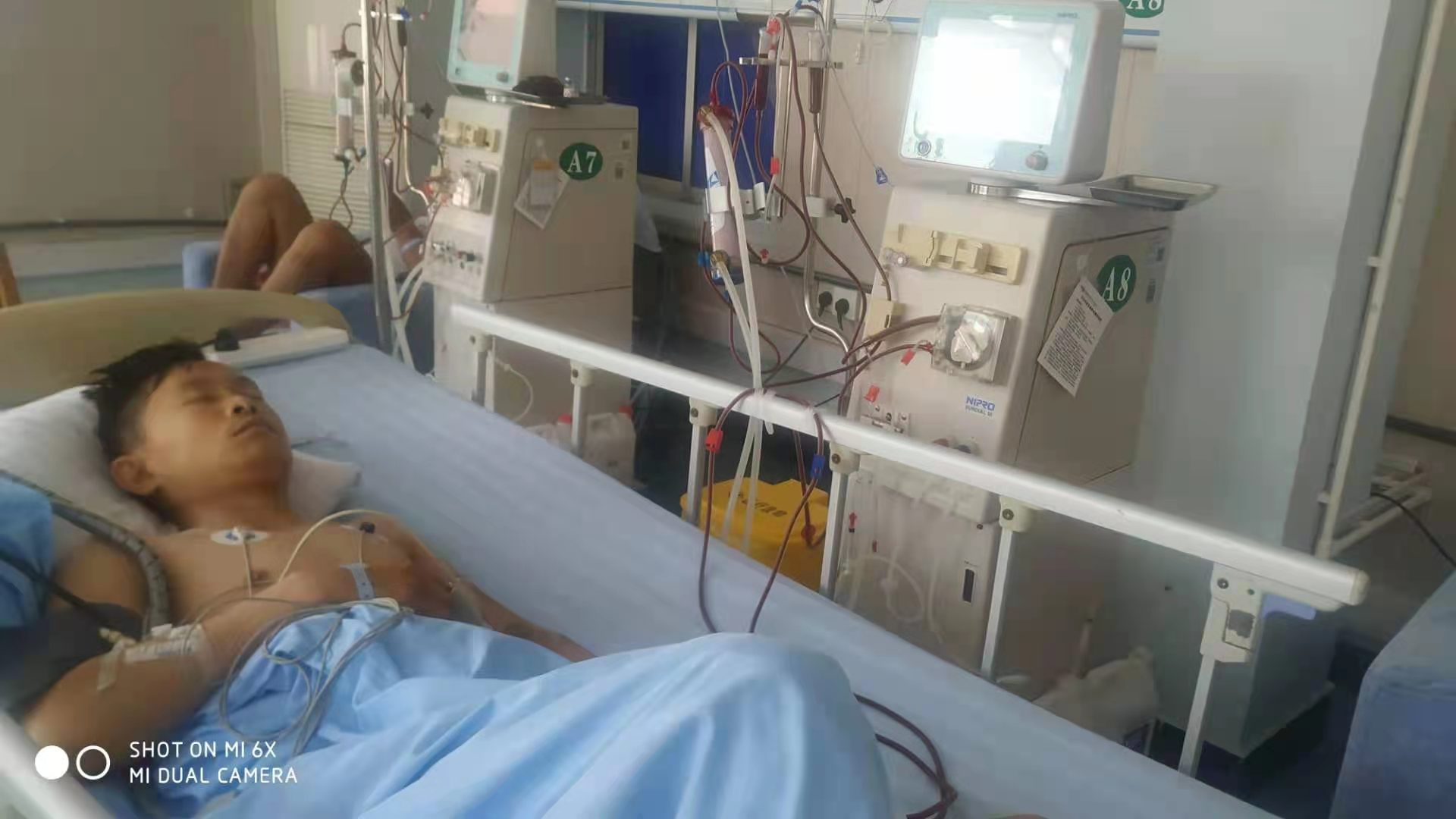 尿毒症夫妇和病友,尿毒症夫妻透析五六年